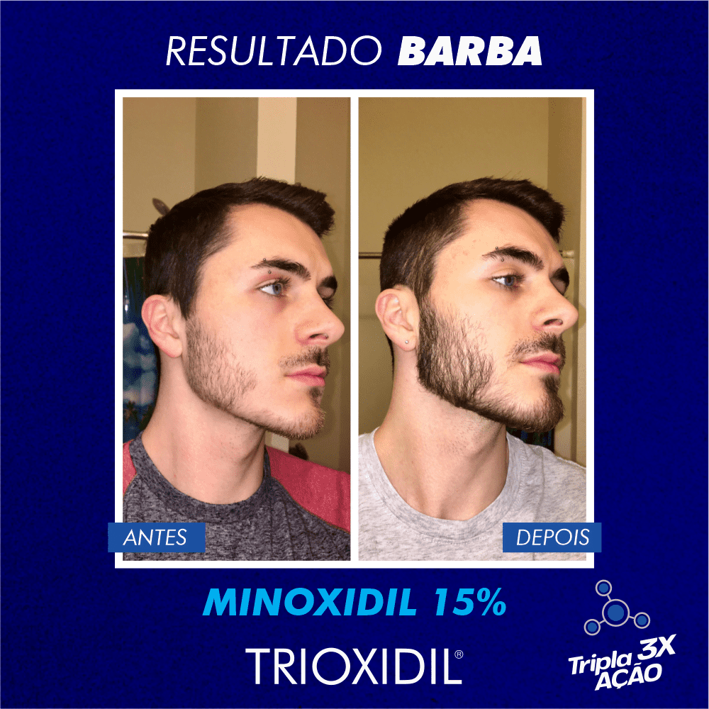 TRIOXIDIL EU BARBUDO