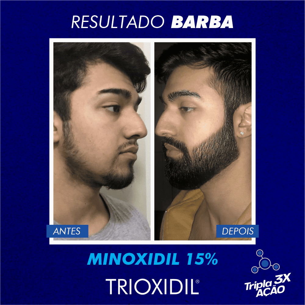 TRIOXIDIL EU BARBUDO