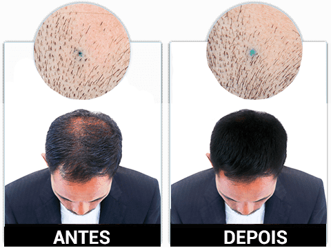 KORUVITAL funciona mesmo antes e depois